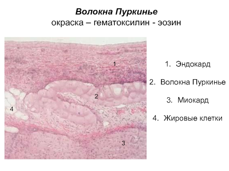 Эндокард рисунок гистология