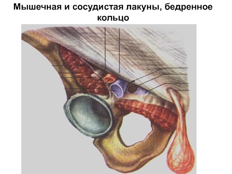 Сосудистая лакуна. Мышечная лакуна и сосудистая лакуна. Бедренный канал мышечная и сосудистая лакуны. Мышечная и сосудистая лакуны бедра. Мышечная лакуна анатомия.