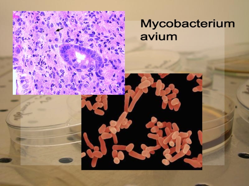 Микобактерия какая. Возбудитель — Mycobacterium paratuberculosis.. Mycobacterium rubrum морфология. Микобактериум Авиум.