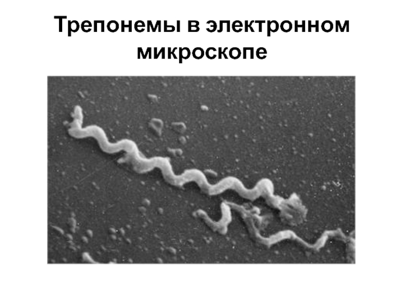 Бледная трепонема treponema pallidum. Трепонемы микробиология. Бледная трепонема микроскоп. Трепонема паллидум микроскопия.
