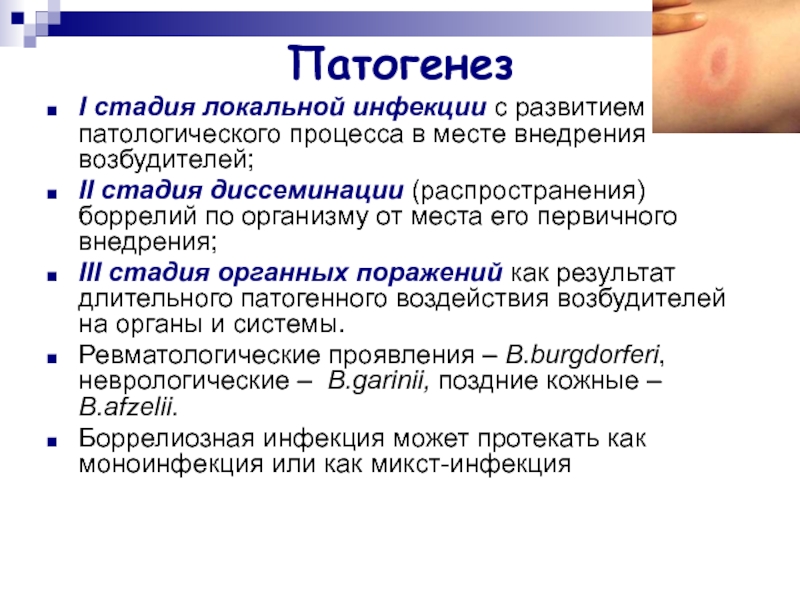 Схема распространения патологических процессов по брюшной полости