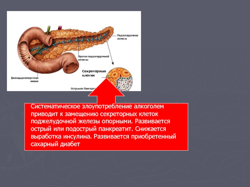 Диабет поджелудочной железы. Поджелудочная железа диабет. Выработка инсулина поджелудочной железой. Инсулин вырабатывается в поджелудочной железы. . Снижение выработки инсулина поджелудочной железой.