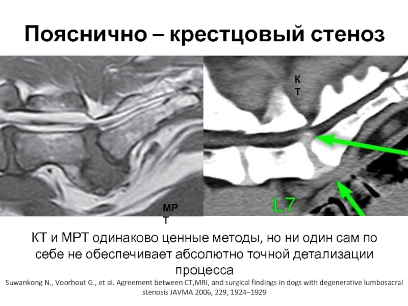 Пояснично – крестцовый стенозМРТКТSuwankong N., Voorhout G., et al. Agreement between CT,MRI, and surgical findings in dogs