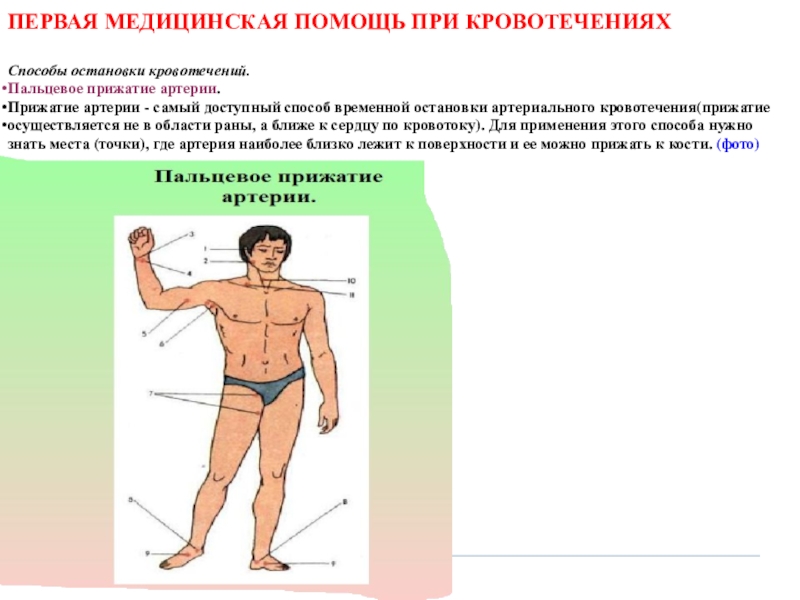 Способы остановки кровотечения пальцевое прижатие артерии