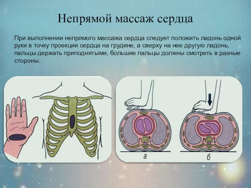 Презентация на тему непрямой массаж сердца