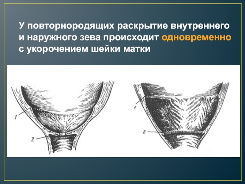 Наружный зев шейки матки фото