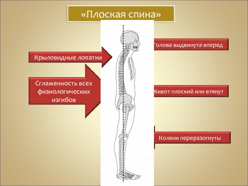 Картинки плоская спина