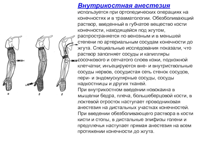 Что такое местная анестезия при операции