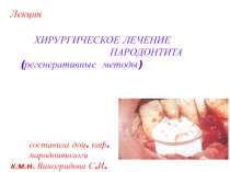 Регенеративные методики
