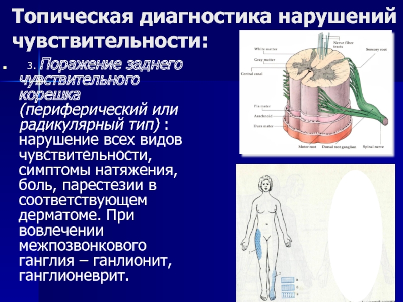 Нарушение чувствительности неврология. Чувствительность неврология презентация. Типы нарушения чувствительности. Топический диагноз в неврологии пример.