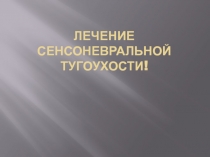 сенсоневральная тугоухость 