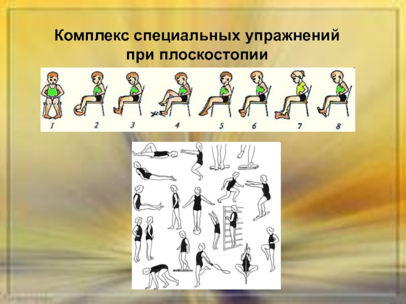 Комплекс упражнений при плоскостопии с картинками