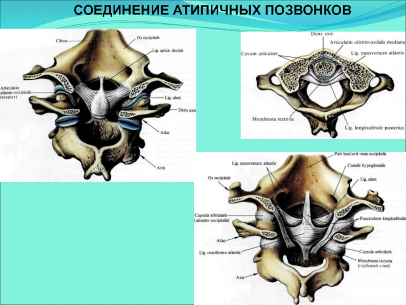 Шейные позвонки соединение. Соединения позвонков. Атипичные позвонки. Атипичные шейные позвонки. Типичные и атипичные позвонки.
