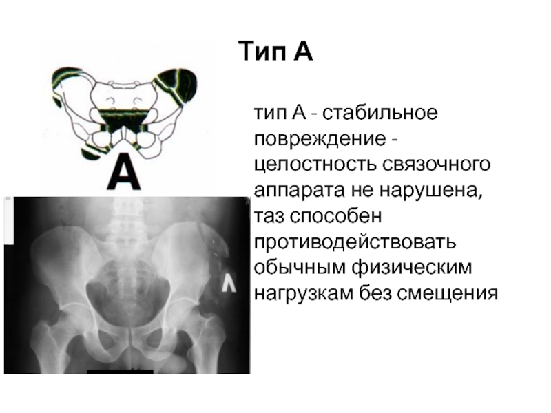 Связочный аппарат лица картинки