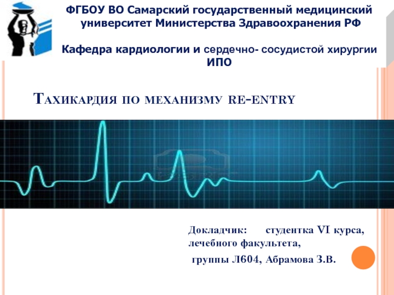 Тахикардия по механизму re-entry