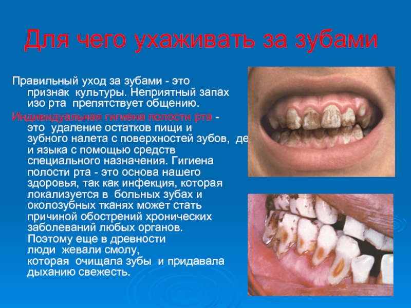 Для чего ухаживать за зубамиПравильный уход за зубами - это признак  культуры. Неприятный запах изо рта  препятствует