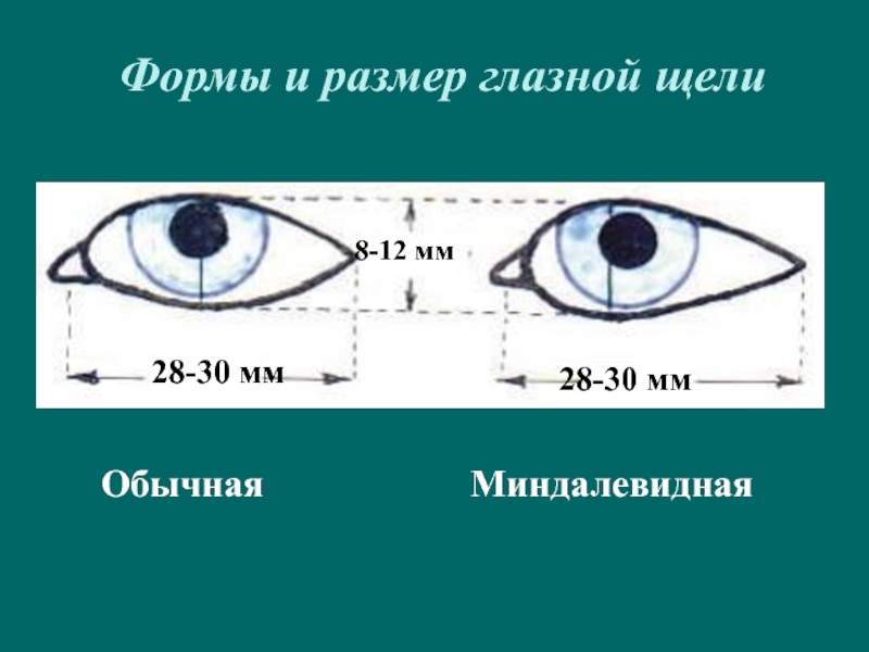 Глазная щель. Ширина глазной щели. Форма глазной щели. Глаза по форме глазной щели. Размер глаз криминалистика.