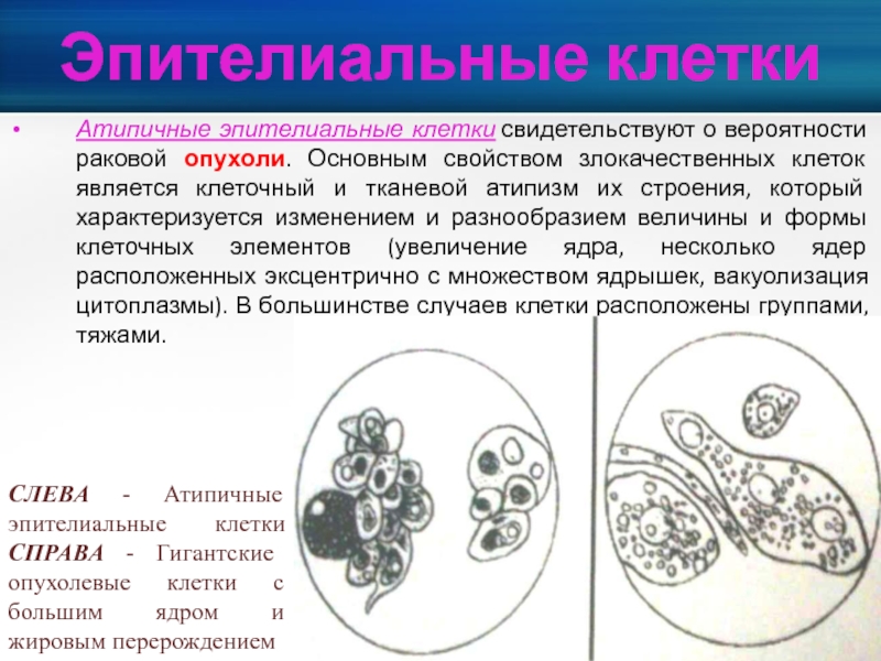 Тканевой атипизм рисунок