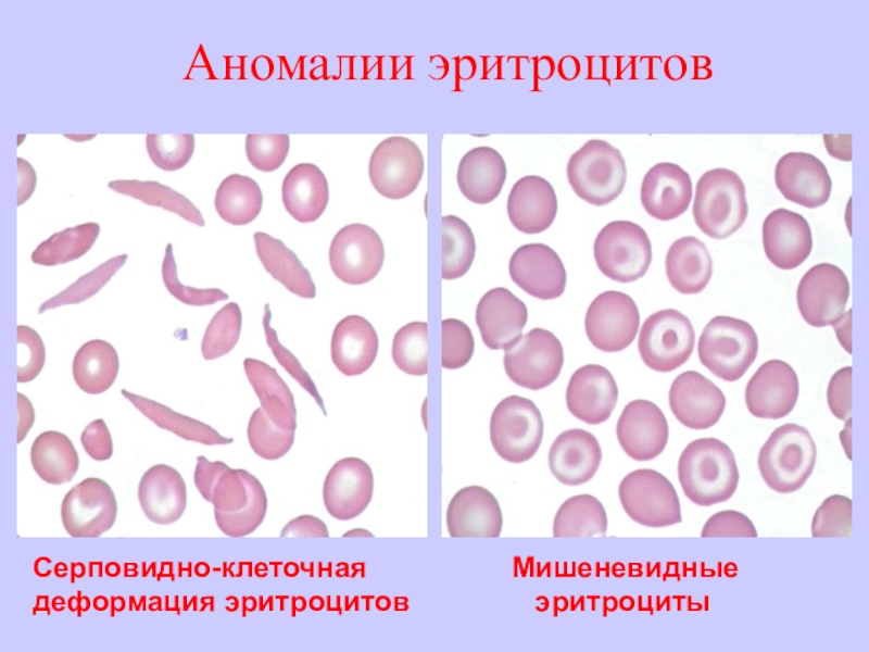 Если на эритроцитах обнаружены антигены а и в то исследуемый образец крови относится к группе