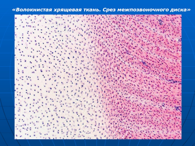 Волокнистый хрящ рисунок с подписями