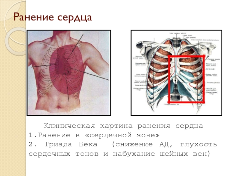 Можно ли выжить после ранения в сердце