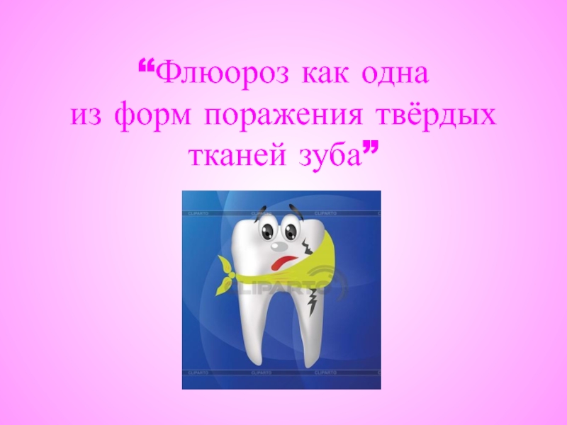 Презентация Флюороз как одна из форм поражения твёрдых тканей зуба
