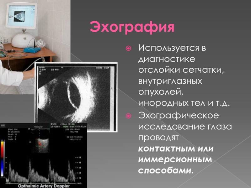 Методы обследования органа зрения презентация