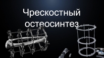 Чрескостный остеосинтез