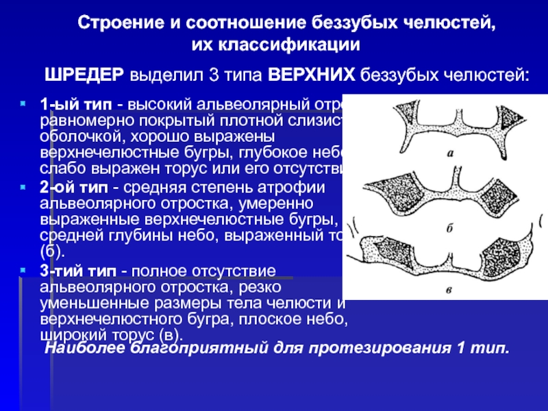 Беззубая челюсть по шредеру. Степени атрофии альвеолярного отростка. Степень атрофии альвеолярного отростка классификация. Соотношение беззубых челюстей. Атрофия альвеолярного отростка классификация.