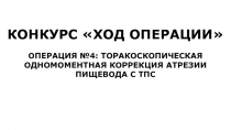 КОНКУРС ХОД ОПЕРАЦИИ
ОПЕРАЦИЯ №4: ТОРАКОСКОПИЧЕСКАЯ ОДНОМОМЕНТНАЯ КОРРЕКЦИЯ