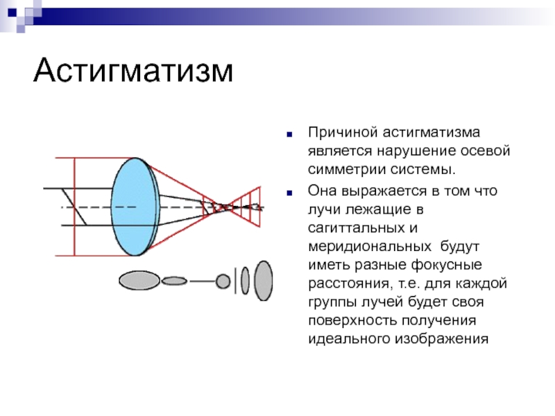 Явление сферической аберрации способствует созданию четкого изображения на сетчатке