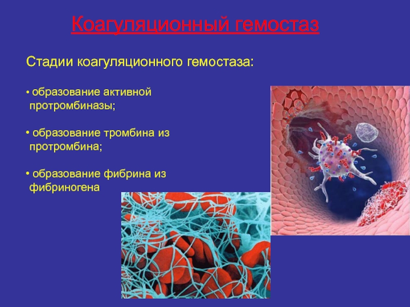 Коагуляционный гемостазСтадии коагуляционного гемостаза: образование активной протромбиназы; образование тромбина из протромбина; образование фибрина из фибриногена