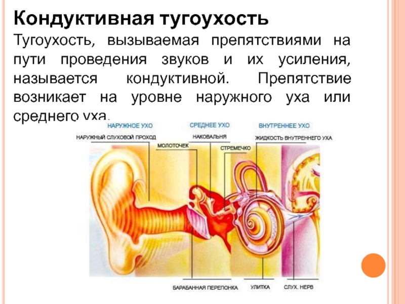 Тугоухость что это. Нейросенсорная тугоухость симптомы. Кохлеарный неврит Тип тугоухости. Кондуктивная и нейросенсорная тугоухость. Острая нейросенсорная тугоухость симптомы.