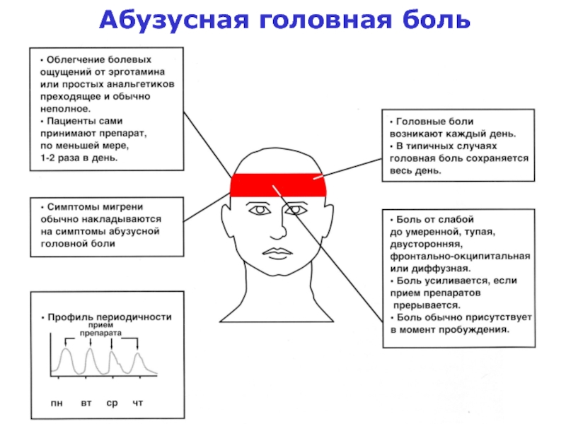 Схема головной боли