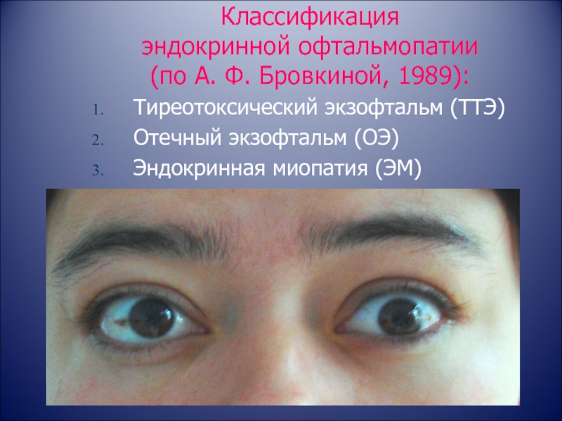 Миопатия глаза что это