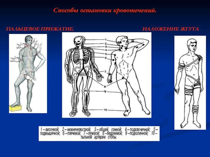 Рисунок названием артерий и костей к которым осуществляется прижатие артерии при кровотечении