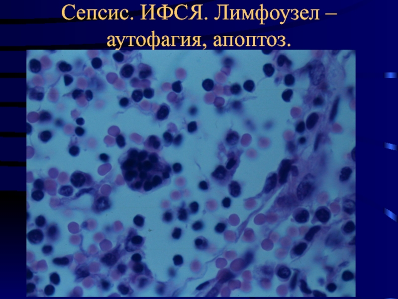 Патологическая анатомия сепсиса презентация