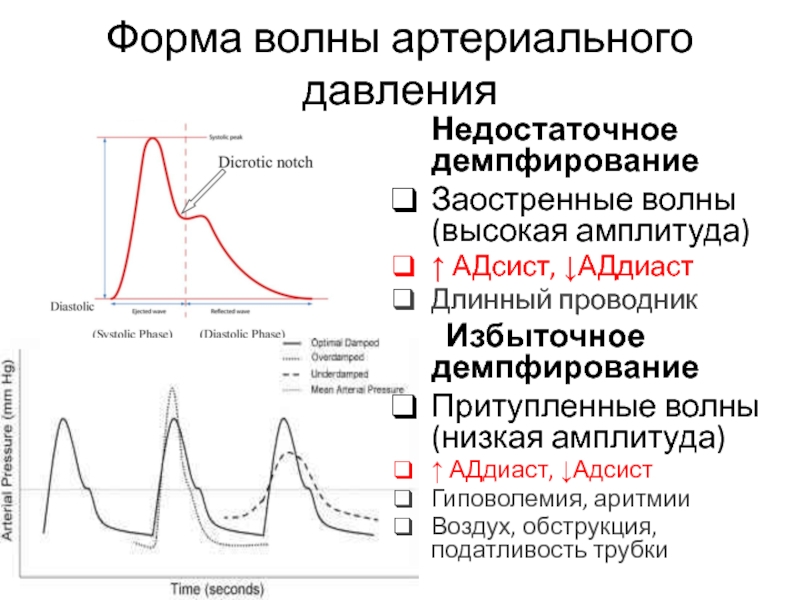 Высокая амплитуда. Волны артериального давления. АДСИСТ И АДДИАСТ. Низкая амплитуда низкая амплитуда. Амплитуда волновой формы.