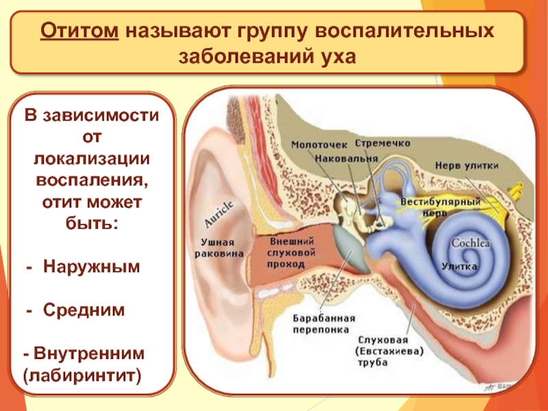 Заболевания внутреннего уха презентация