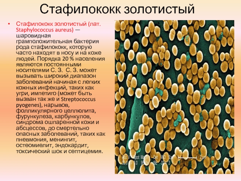 Staphylococcus aureus в носу. Бактерия золотистый стафилококк. S. aureus золотистый стафилококк. Стафилококк ауреус на коже. Жёлтый стафилококк золотистый.
