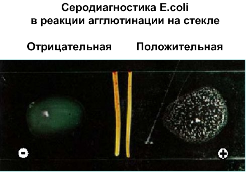 Реакция агглютинации фото