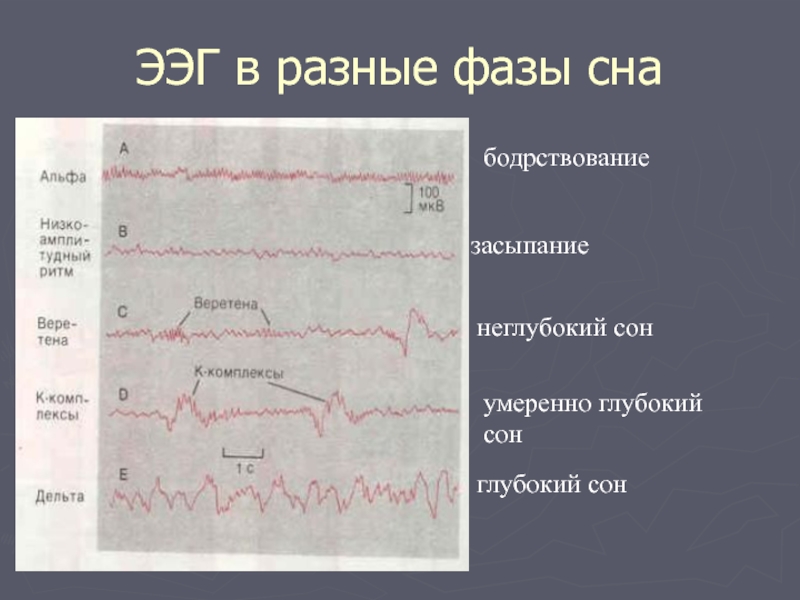 1 нарисовать схему стадий сна по данным ээг