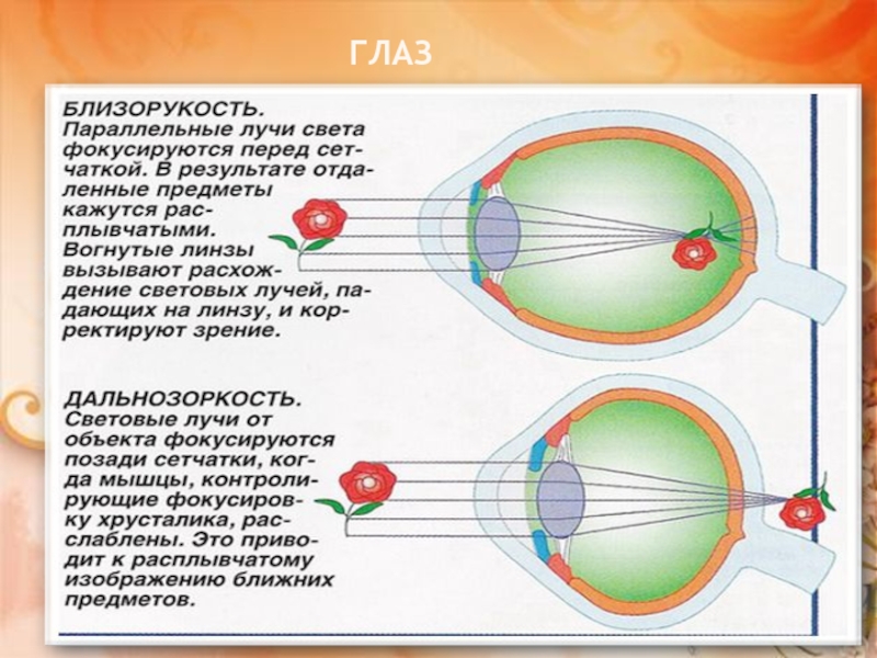 Изображение предметов фокусирующихся перед сетчаткой это