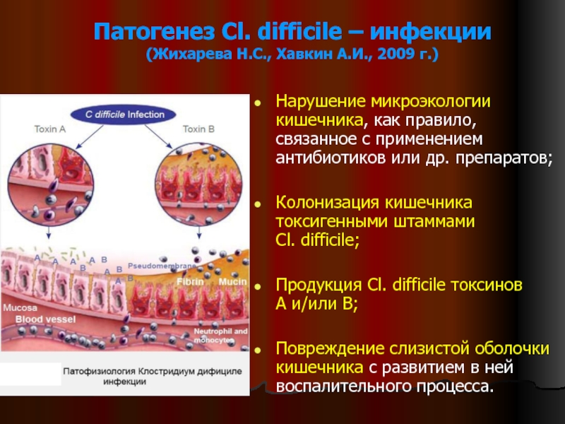 Цитограмма воспалительного процесса слизистой оболочки на фоне дисбиоза