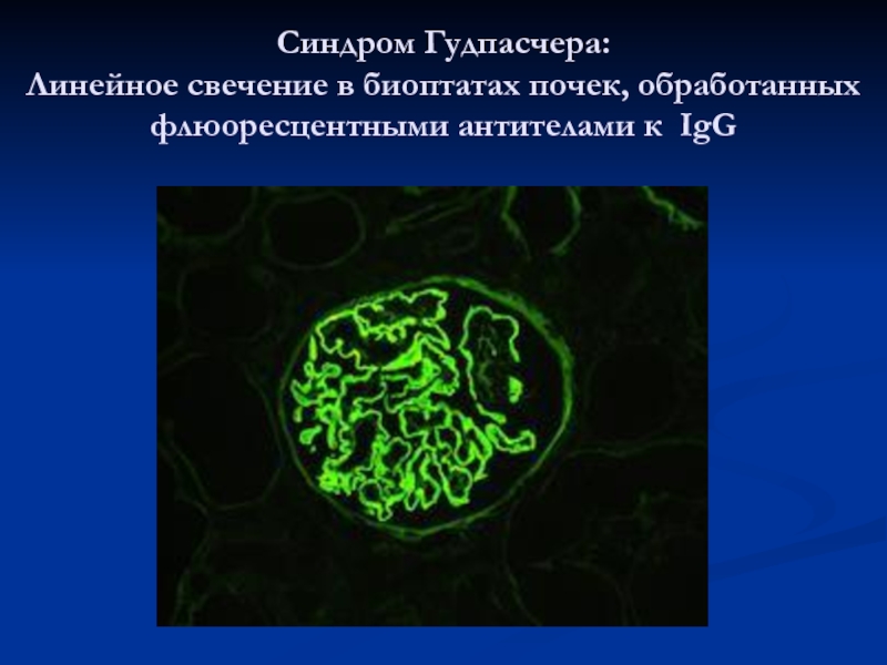 Синдром гудпасчера презентация
