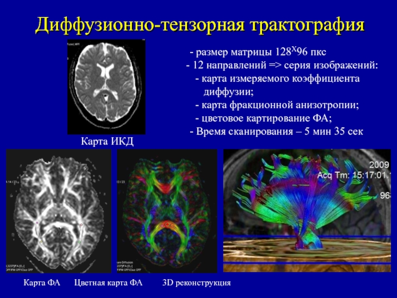 Диффузионно взвешенное изображение