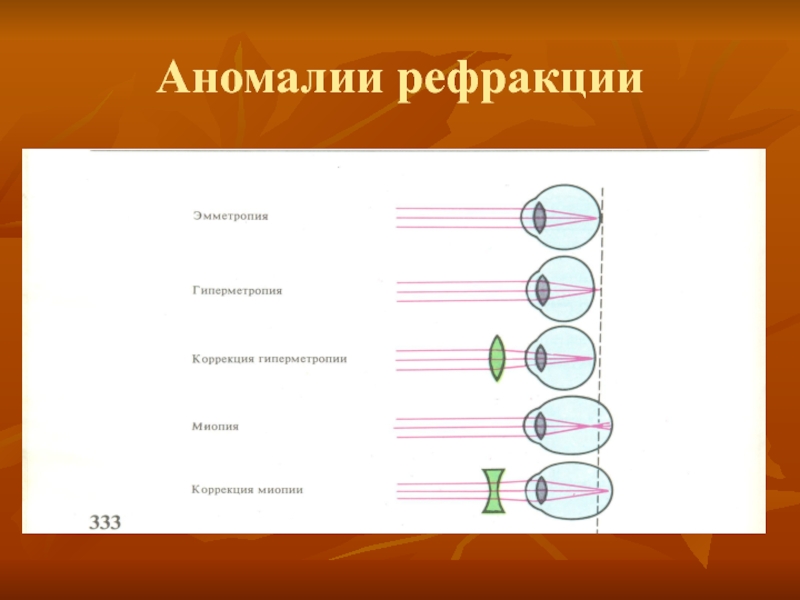 Аномалии клинической рефракции. Эмметропия миопия гиперметропия астигматизм. Аномалии рефракции глаза физиология. Принципы коррекции аномалий рефракции. Схему рефракции при эмметропии.