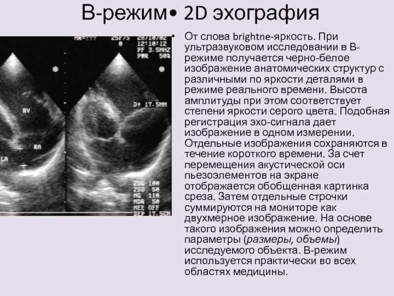 Исследование с 2 с. B режим ультразвукового исследования. Режимы сканирования УЗИ. Режимы исследования в УЗД. М метод ультразвукового исследования.