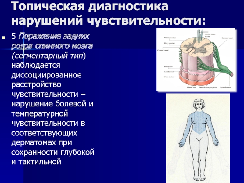 Болевое нарушение чувствительности