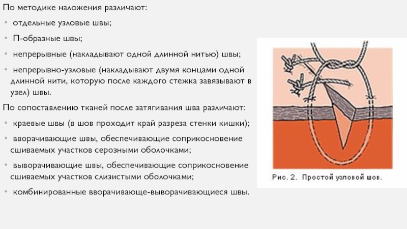 Наложение шва латынь. Последовательность наложения кишечных швов. Узловой и непрерывный кишечный шов. Непрерывный Узловой шов. Наложение непрерывного шва.